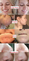 Diystar™  Green Tea Deep Cleanse Mask Stick
