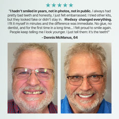 Medazy Custom-Fit Full Functional Dentures
